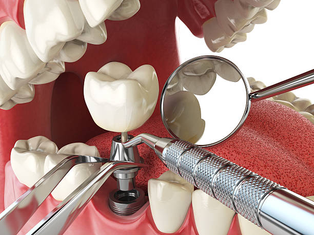 Best Emergency Dental Care for Broken or Chipped Teeth in Mahanoy City, PA